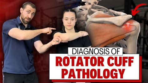 how to test rotator cuff tear|diagnosing rotator cuff tear.